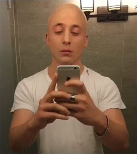 jeremy allen white bald.